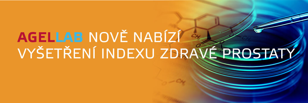 INDEX ZDRAVÉ PROSTATY PHI pomůže rozhodnout